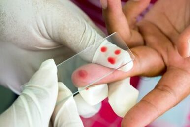 Diagnoza bólu w stawach palców