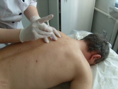 Śródstawowe zastrzyki chondroprotektorów w osteochondrozie klatki piersiowej